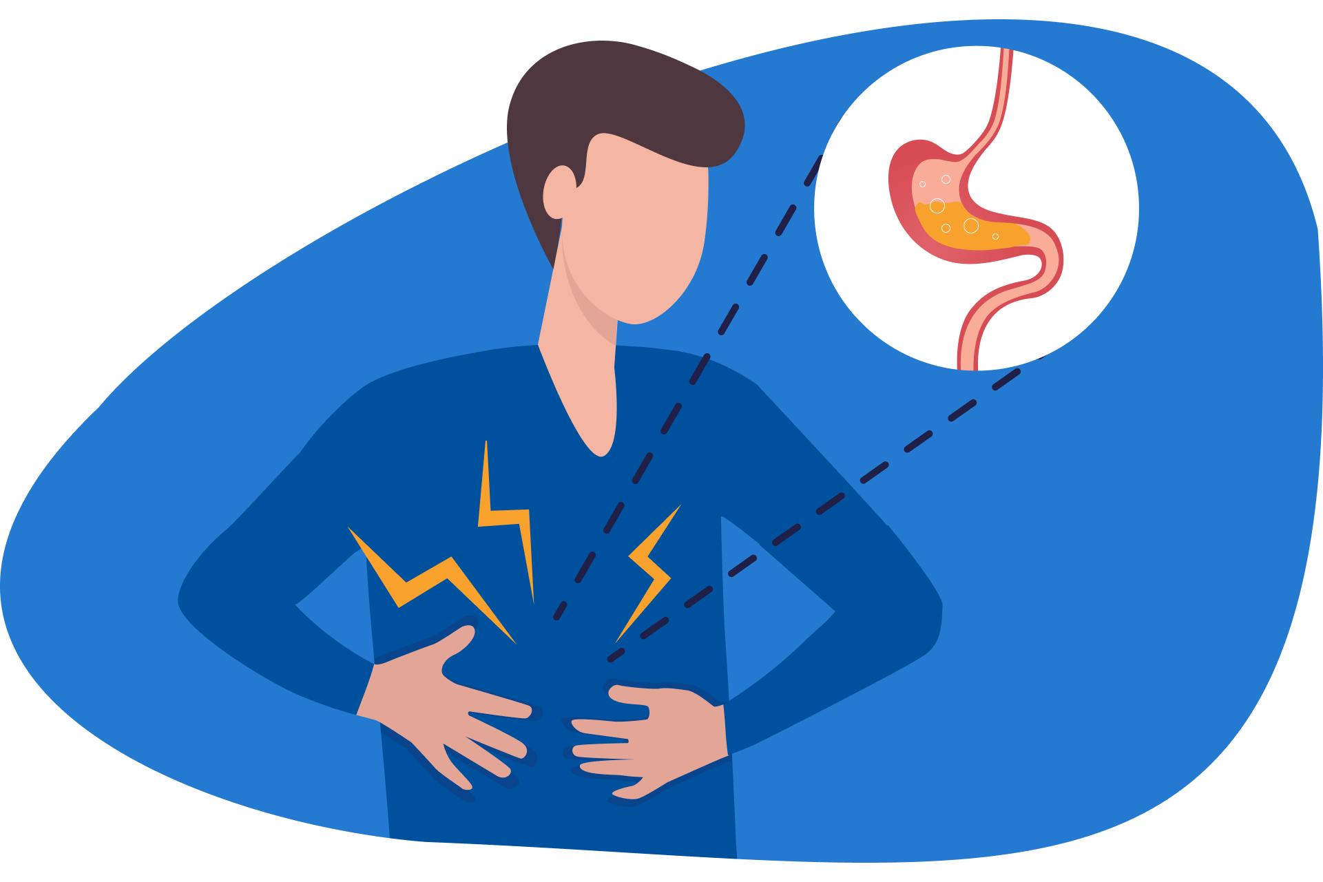 Almofada Anti-refluxo